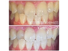 ホワイトニングルーム 横浜店(Whitening Room)/ホワイトニング/横浜