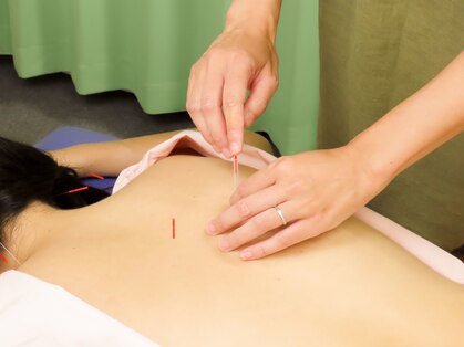 ナディ鍼灸治療院の写真