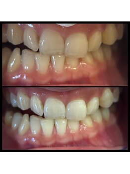 ホヌオラ(Honu Ola)/☆1ヶ月通い放題メニュー☆