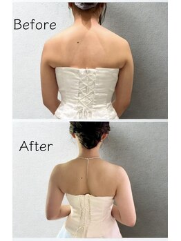 ルルン(LuLuN)/ブライダルエステ