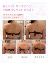 ティアラ(Tiara)/