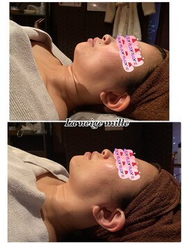 ラネージュミル(La neige mille)/フェイシャル