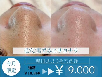 ラデュープラス(Radieux+)