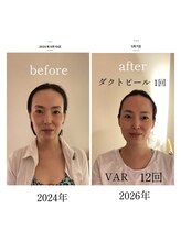 スパ 香炉/GUINOT美容機器VARフェイシャル