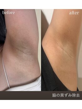 ミニョン(mignon)/ローマピンク