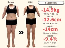 ニドム/51歳　-15kg大幅痩身ダイエット1