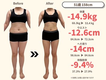 ニドム/51歳　-15kg大幅痩身ダイエット1