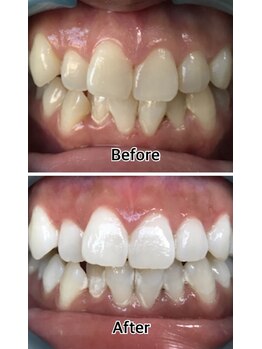 ドクターモック(Dr.MOC)/ＢＥＦＯＲＥ→ＡＦＴＥＲ