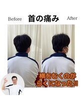 三条かがやき整体院/首の痛み改善