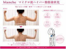 オリエンタルローザ 表参道(Oriental Rosa)/マイクロ波ハイパー脂肪液化術！