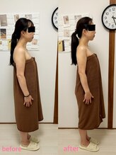 ルアナ(LUANA)/ヘッドスパ、before→after