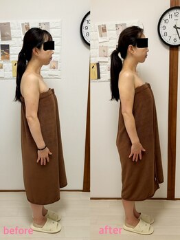 ルアナ(LUANA)/ヘッドスパ、before→after
