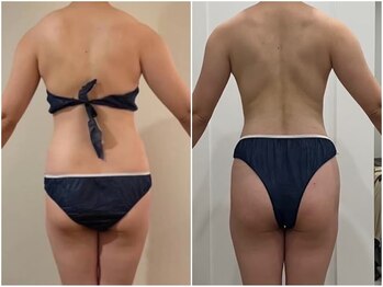 シルク ド ココ(Silk de Coco)/リジュスキャルプ+全身整体