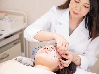 ハリリーナ 静岡(Haririna)の写真/低刺激でも効果をしっかり引き出します◎心地いい刺激で肌組織を最大限活性化させる、当店独自の美容鍼♪
