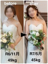 ハッチー(Hacchi)/【30代】ブライダル痩身！