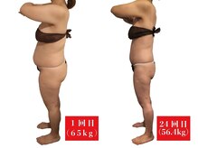 アマンシィ(Amincir)/【Before/After】エンダモロジー