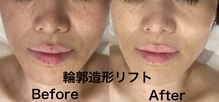 ビューティーサロン セガール(segar)