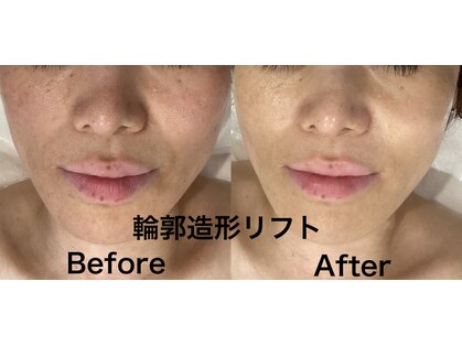 ビューティーサロン セガール(segar)の写真