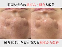 アエオボンヌール(A.E.O BONHEUR)の雰囲気（お肌のデトックスでニキビ・毛穴を根本改善）