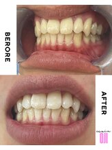 エクシアホワイトニング 王寺店/