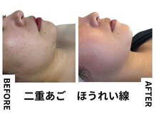 シェリートーキョー 成田店(Cherie Tokyo)