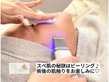 クリアホワイト(Clear White)/表面のザラつきを除去♪
