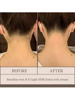 ルディ 阿波座店(rudi)/うなじ ワックス&光脱毛