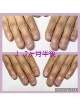 ブルームブルーム(BLOOMブルーム)/ビフォーアフター