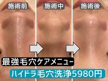ブリリオ 天神店(Brillio)の雰囲気（Brillioメソッド肌質改善◆クリスティーナ等をフルライン導入）