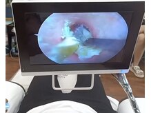 イヤーエステ耳舎