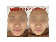 ちゅるん肌.com なかもず店