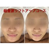 ちゅるん肌.com なかもず店