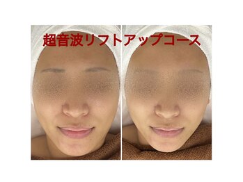 ちゅるん肌.com なかもず店