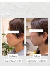 リノ ショウナン(LINO SHONAN)/ポテンツァ