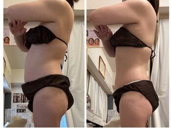 さとう美容整体 川崎本店/50代でもダイエット成功者続々！