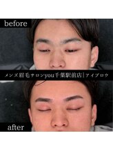 ユー 千葉駅前店(you)/ビフォ－アフター写真