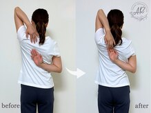 エーアール(AR)/【Before/After】3回目