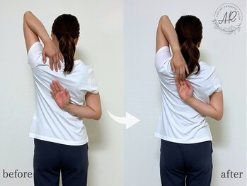 エーアール(AR)/【Before/After】3回目