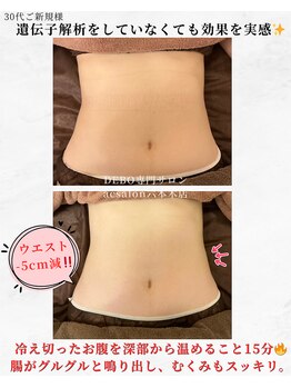 エーシーサロン 六本木店(acsalon)/遺伝子解析前でも15分で-5cm!