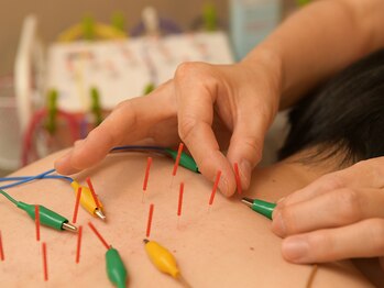 かすがい鍼灸院リハート(Re.heart)