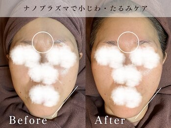 ハリウッド ラボ 本店(HOLLYWOOD LAB)/