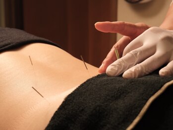 チョウノヤシロの写真/“体を中から本気で変えたい”最後の砦◎自律神経/体内改善/体内冷え解消/むくみ/疲れやすい方に◎