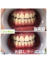 ルブラン 奈良店(Le Blanc)/30分の時間が楽しみに思える