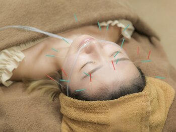 中島整骨院 鍼灸院 整体院/美容鍼と水素吸引です