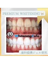 ホワイトニングカフェ 郡山店/歯科用ジェルあり♪