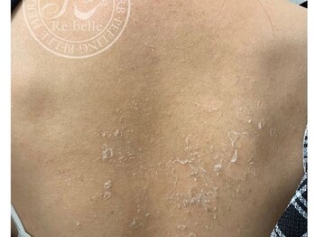 ベルシア ボディアンドアイラッシュ(Belsia)/【リベル】ハーブピーリング