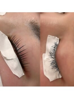 アンリミテッド(Unlimited)/お直し