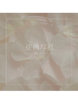 ベッピン(Beppin)/症例写真