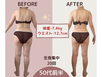 エテルナ(Eterna)/安城市　ダイエット　痩身