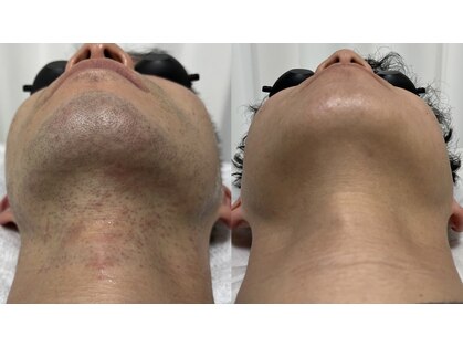 アールビューティー(R Beauty)の写真